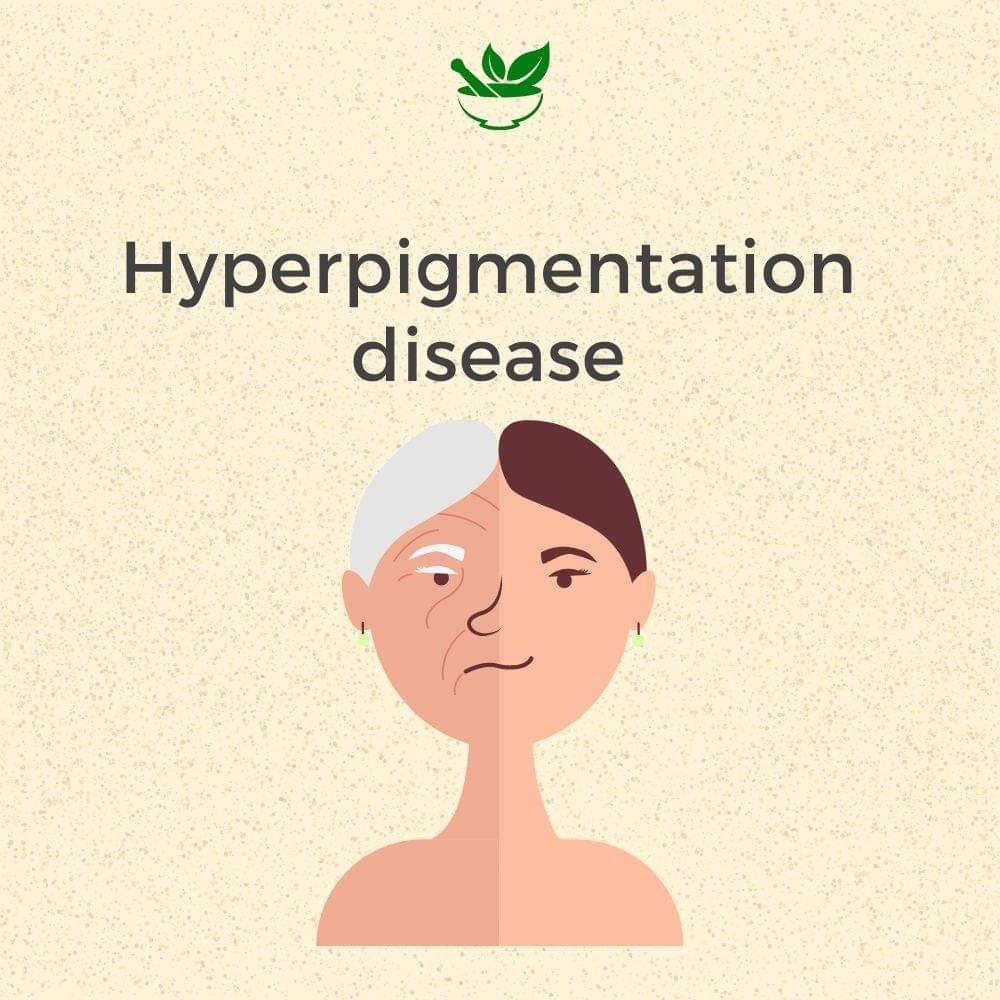 Deep Ayurveda Anti Hyperpigmentation Ayurvedic Management 30 Days Pack