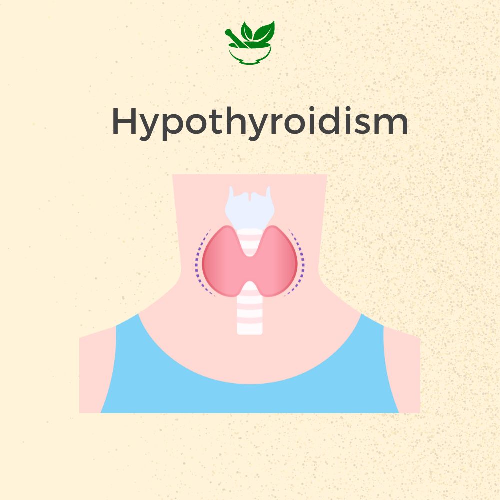Deep Ayurveda Hypothyroidism Care Ayurvedic Management 30 Days Pack
