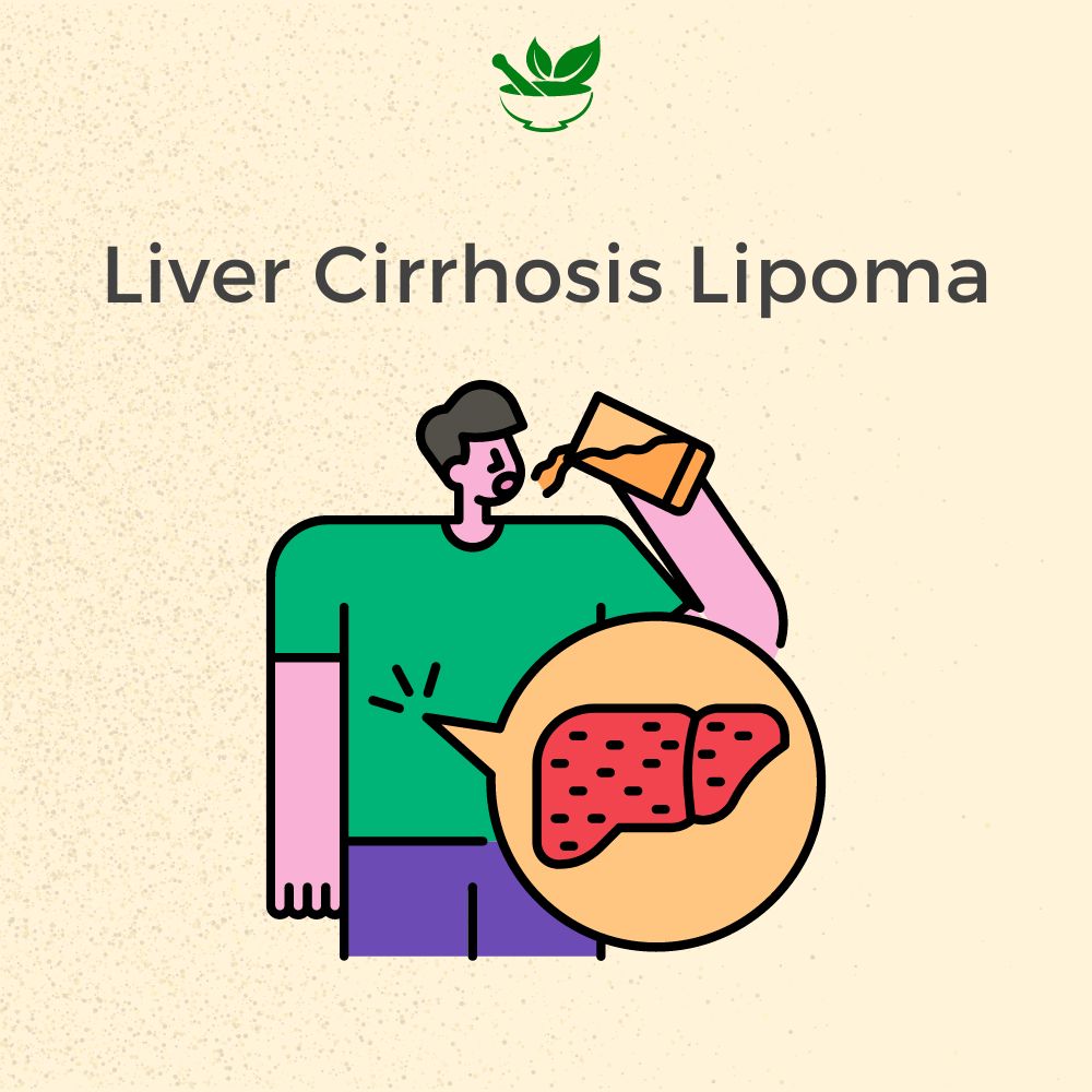 Deep Ayurveda liver cirrhosis ayurvedic mangement 30 days pack
