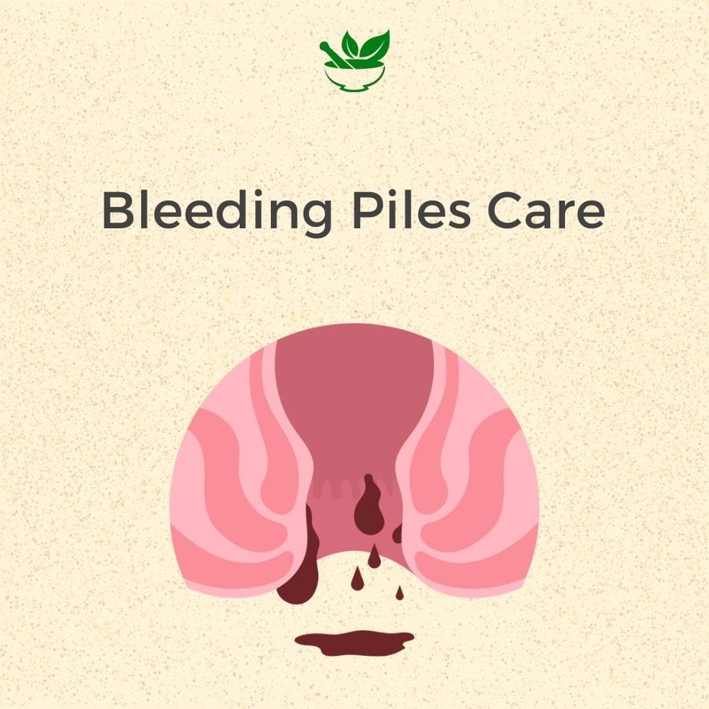 Deep Ayurveda Bleeding Piles Ayurvedic Management 30 Days Pack