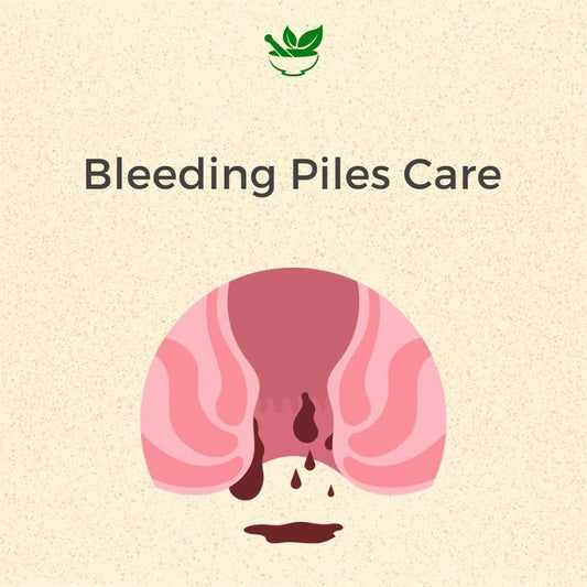 Deep Ayurveda Bleeding Piles Ayurvedic Management 30 Days Pack