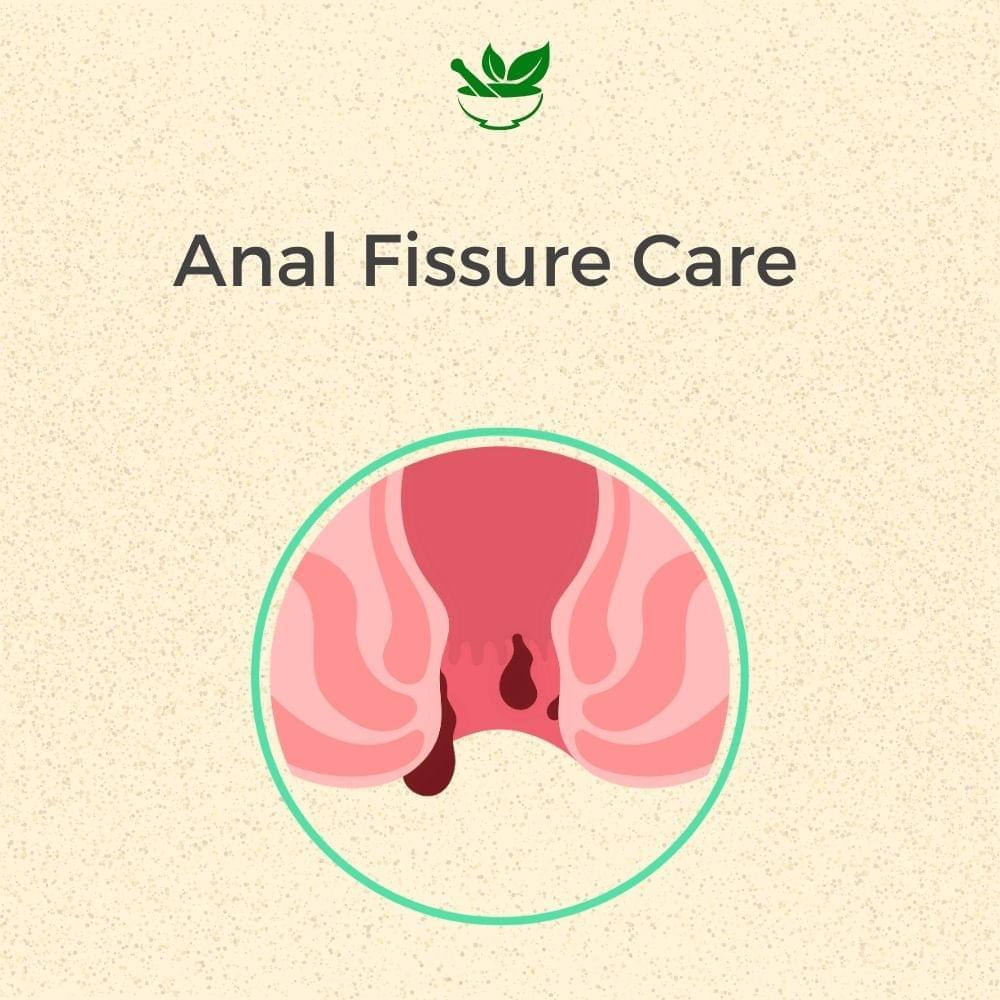 Deep Ayurveda Anal Fissure Ayurvedic Management 30 Days Pack