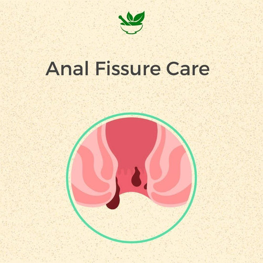 Deep Ayurveda Anal Fissure Ayurvedic Management 30 Days Pack