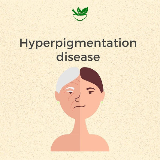 Deep Ayurveda Anti Hyperpigmentation Ayurvedic Management 30 Days Pack