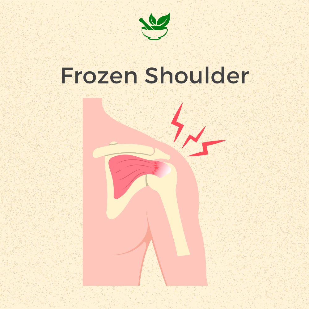 Deep Ayurveda Frozen Shoulder Ayurvedic Management 30 Days Pack