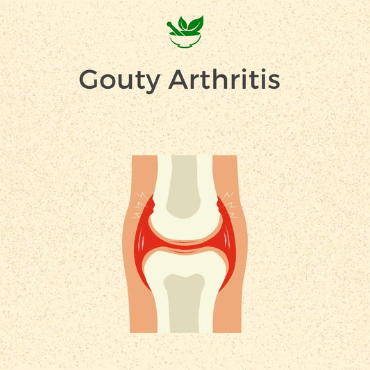 Deep Ayurveda Gouty Arthritis Ayurvedic Management 30 Days Pack