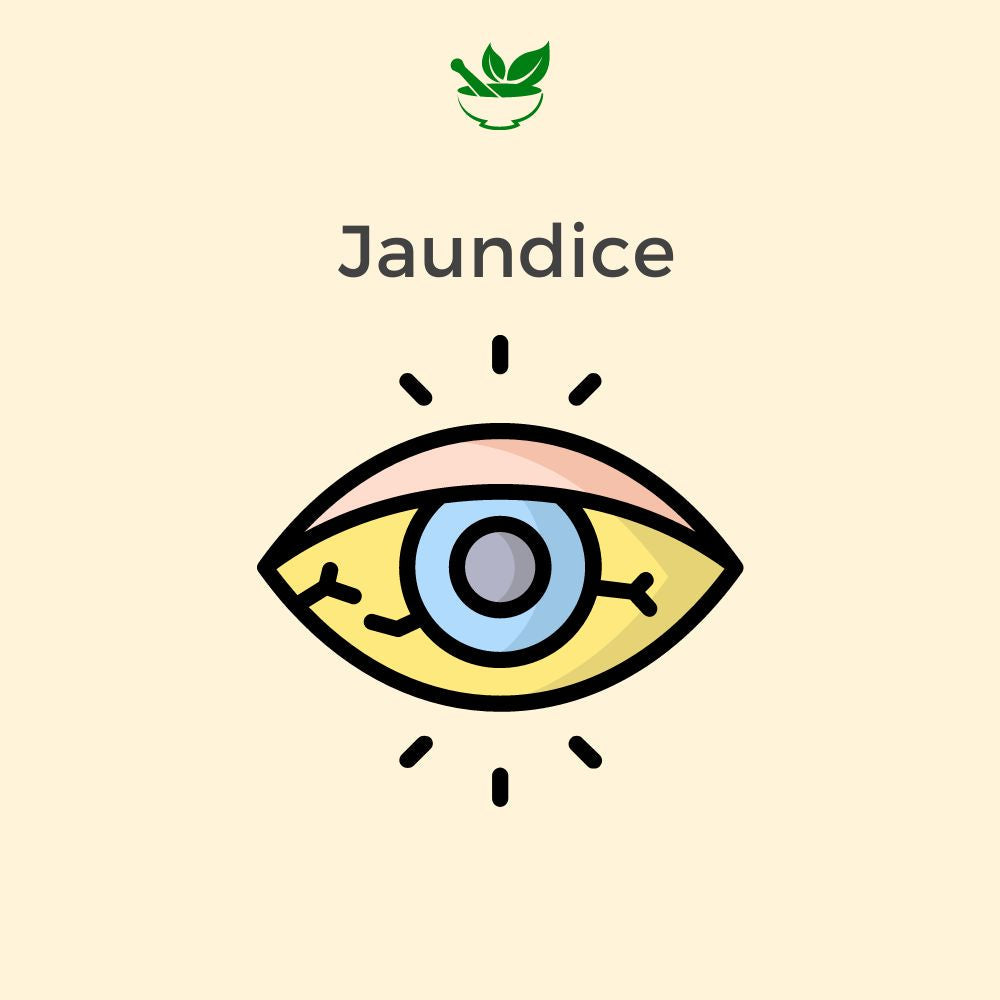 Deep Ayurveda Jaundice Ayurvedic Management 30 Days Pack