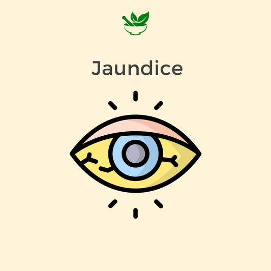 Deep Ayurveda Jaundice Ayurvedic Management 30 Days Pack